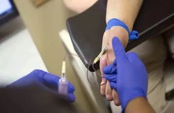 Jaundice Diet: पीलिया की समस्या होने पर अपनी डाइट में जरूर शामिल करें ये फूड्स