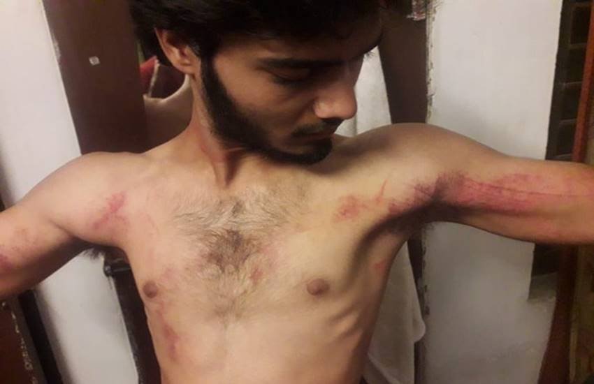 इस तस्वीर को आप सांसद संजय सिंह ने ट्वीट करते हुए लिखा- युवाओं छात्रों से इतनी नफ़रत । ये हैं शशिभूषण पांडेय। एक नेत्रहीन JNU का छात्र। किस बर्बरता से दिल्ली पुलिस ने इनको पीटा है आप खुद देखिये।