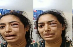 पति ने मारते-मारते मुंह सुजा दिया, महिला ने वायरल किया वीडियो, पुलिस आई हरकत में