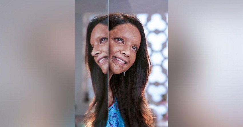 छपाक: 10 जनवरी को मेघना गुलजार की फिल्म छपाक रिलीज होगी। फिल्म में दीपिका पादुकोण एसिड अटैक सर्वाइवर लक्ष्मी का किरदार निभा रही हैं।