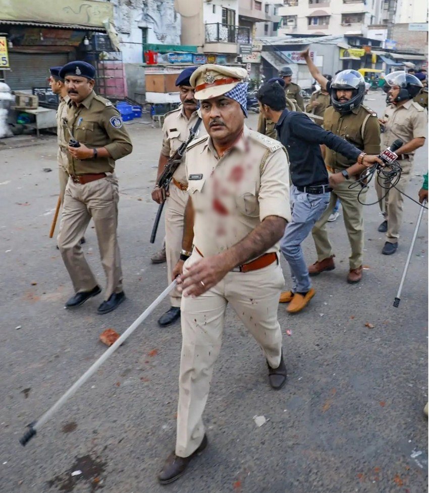 खून से सने अहमदाबाद के एसीपी राजपाल सिंह की इस तस्वीर को शेयर करते हुए लोग लिख रहे हैं कि हिंसक हो रहे प्रदर्शनकारियों को देखते ही गोली मार देने के आदेश दे देनी चाहिए।