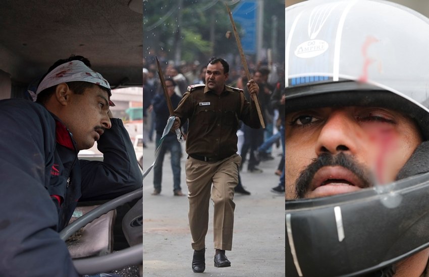 देश के कई इलाकों और शिक्षण संस्थानों में नागरिकता संशोधन कानून (CAA) को लेकर विरोध प्रदर्शन हो रहा है। कई जगह इस प्रदर्शन ने हिंसक रूप भी अख्तियार कर लिया। इन हिंसक प्रदर्शनों को देखते हुए सरकार ने प्रभावित इलाकों में कर्फ्यू लगाने से लेकर इंटरनेट सेवाएं बंद करने तक का कदम उठाया है। इन प्रदर्शनों के मद्देनजर भारी में संख्या पुलिसबल भी मुस्तैद है। कई जगह पर प्रदर्शनकारियों और पुलिस के बीच टकराव भी हुआ। इनमें कई पुलिसवालों को चोटें भी आईं। प्रदर्शनकारियों के हमले में किसी पुलिसवाले का सिर फूटा तो किसी का पैर टूटा। मीडिया से लेकर सोशल मीडिया तक में ऐसी तमाम तस्वीरें शेयर हो रही हैं।