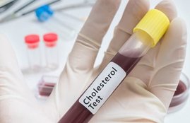 Health News, Health News in Hindi, Cholesterol, cholesterol foods, cholesterol symptoms, cholesterol diet, cholesterol function, cholesterol structure, cholesterol test, high cholesterol treatment, cholesterol levels