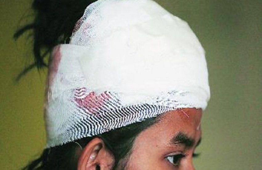 घायल जेएनयू छात्र संघ की अईशी घोष, फोटो सोर्स- इंडियन एक्सप्रेस