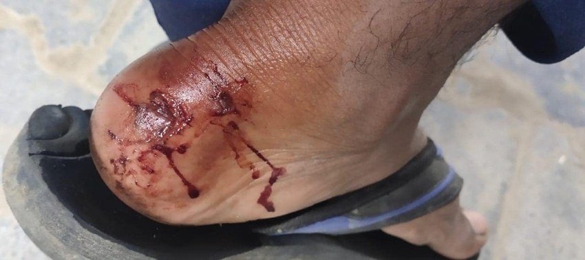 वहां के लोगों का कहना है कि पुलिस ने 5 फरवरी की सुबह 4 बजे के करीब प्रदर्शनकारियों पर लाठीचार्ज कर दिया जिससे कई लोग घायल हो गए।