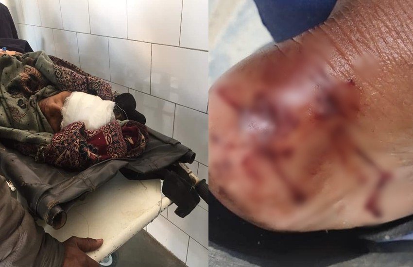 नागरिकता संशोधन कानून को लेकर देशभर में विरोध प्रदर्शन हो रहे हैं। दिल्ली के शाहीन बाग से लेकर लखनऊ के घंटाघर तक पर लोग प्रदर्शन कर रहे हैं। इन प्रदर्शनों में महिलाएं बढ़-चढ़ कर हिस्सा ले रही हैं। इसी कड़ी में 4 फरवरी को आजमगढ़ के बिलरिया गंज में बड़ी संख्या में महिलाएं CAA के खिलाफ प्रदर्शन कर रही थीं। लेकिन बिलरियागंज के जौहर पार्क में बैठे इन प्रदर्शनकारियों पर यूपी पुलिस ने 5 फरवरी की अल सुबह सख्ती करते हुए वहां से हटा दिया। सोशल मीडिया में लोग लिख रहे हैं कि पुलिस ने भोर में 4 बजे के करीब प्रदर्शनकारियों पर लाठीचार्ज कर दिया। ऐसे लोगों का आरोप है कि पुलिस ने उनपर पत्थर भी बरसाए। वहीं पुलिस का कहना है कि उन्होंने प्रदर्शनकारियों से प्रदर्शन खत्म करने की अपील की लेकिन उन लोगों ने पुलिस पर ईंट-पत्थर चलाना शुरू कर दिया जिसके बाद हल्का बल प्रयोग करना पड़ा। पुलिस ने लाठीचार्ज से इनकार किया है।