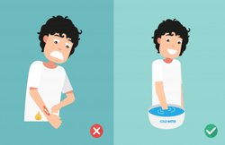 Burning Remedy: 20 मिनट ठंडे पानी में हाथ रखना, जलने पर दे सकता है राहत: स्टडी