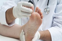 डायबिटीज के मरीजों में एथलीट्स फुट बीमारी है आम, जानिए क्या है इसके लक्षण और बचाव