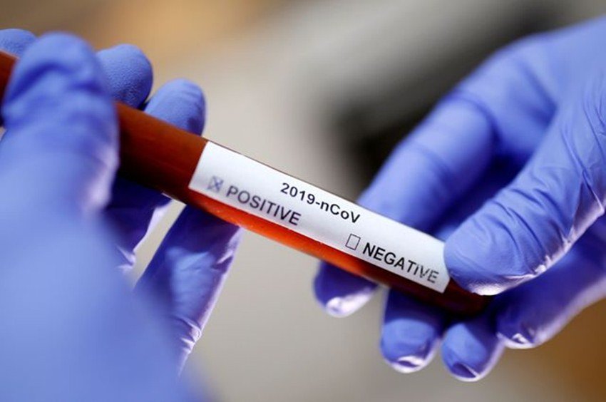 Coronavirus का खौफ पूरी दुनिया में देखने को मिल रहा है। दुनिया के 70 देश इस खतरनाक वायरस की चपेट में आ चुके हैं। चीन से निकले इस वायरस ने अब तक 3,123 लोगों जिंदगी लील ली है।वहीं 91,783 से ज्यादा लोग इस वायरस से संक्रमित है। भारत भी इस वायरस से अछूता नहीं रहा है। अब तक यहां पर 29 केस सामने आए हैं, जिनमें से तीन का इलाज हो गया है और बाकी के इलाज की प्रक्रिया जारी है। फिल्म स्टार सलमान खान ने इस कोरोना वायरस पर रिएक्शन देते हुए सोशल मीडिया में एक पोस्ट किया है।