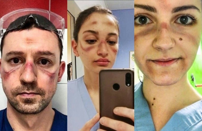 बता दें कि इटली में कोरोना वायरस से संक्रमितों का इलाज करते हुए कई डॉक्टर खुद भी संक्रमित हो चुके हैं। कुछ की तो मौत भी हो गई है।