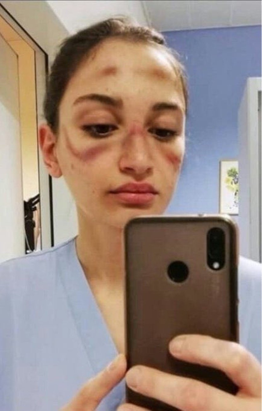 डॉक्टरों की ये तस्वीरें सोशल मीडिया में भी वायरल हो रही हैं।