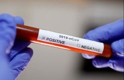 Coronavirus: 500+ विकेट ले चुके पूर्व कीवी क्रिकेटर घर लौटने के लिए मांग रहे पैसा, कहा- बीवी की जान खतरे में