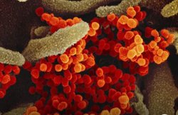 क्या हवा से भी फैल रहा है कोरोना वायरस, जानिये- WHO ने क्या कहा…