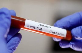 Covid-19, Corona virus