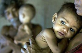 Malnutrition