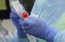 कोरोना से जंग में पाकिस्तान, नेपाल और श्रीलंका से भी पीछे है भारत, अब तक हुए सिर्फ 6.65 लाख टेस्ट