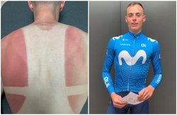 Covid-19: लॉकडाउन के कारण बॉलकनी में प्रैक्टिस कर रहा था एथलीट, पीठ पर छप गया इस देश का नक्शा