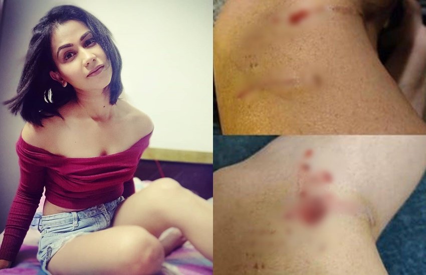 कलर्स टीवी के शो 'मुझसे शादी करोगे' में नजर आ चुकीं एक्ट्रेस आंचल खुराना (Aanchal Khurana) की मुश्किलें कम होती नहीं दिख रही हैं। शो में तबीयत खराब होने के बाद अस्पतला में भर्ती होने वालीं आंचल खुराना पर अब आंवारा कुत्तों ने हमला कर दिया है। इस हमले में आंचल बुरी तरह से घायल हो गई हैं। (Photos: Aancha Khurana Instagram)