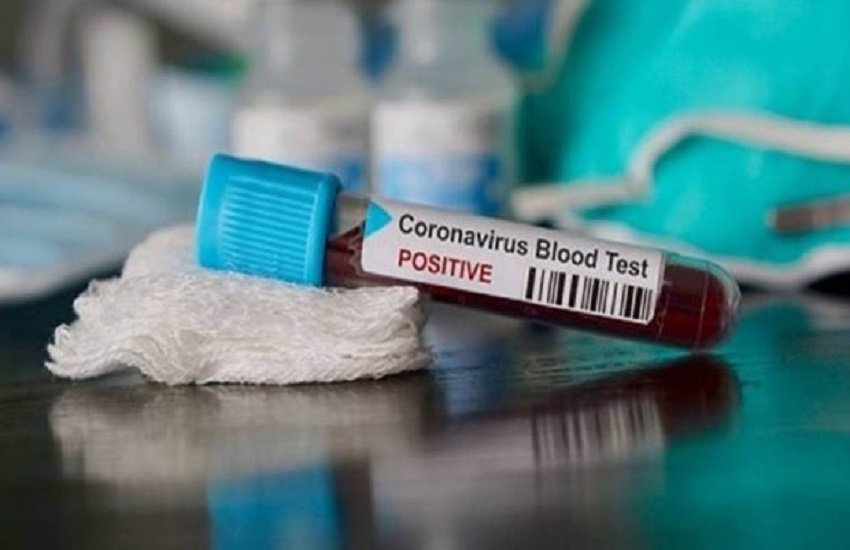 COVID 19, Coronavirus, Lockdown: गुजरात में कोरोना के बिना लक्षण के 9 लोग पॉजिटिव निकले। (indian epress)