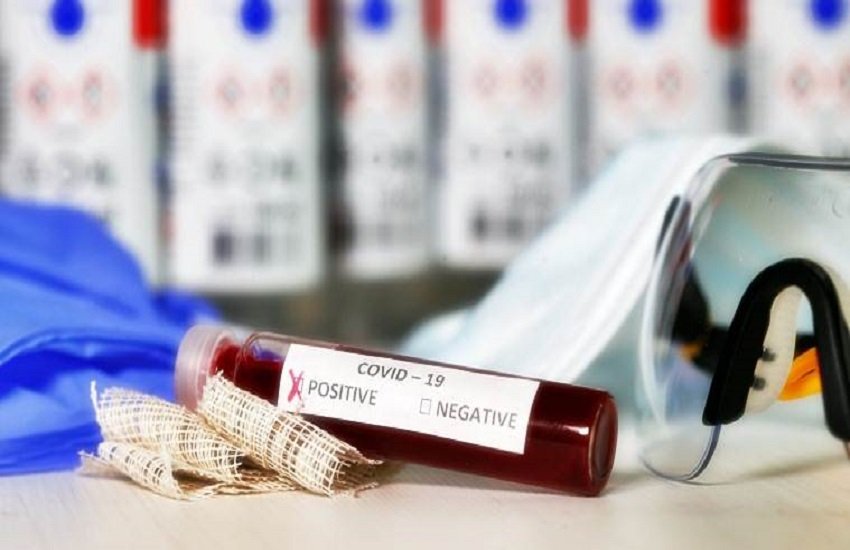 Coronavirus: रैपिड टेस्टिंग कोरोना के संक्रमण की जांच करने वाला एक ऐसा टेस्ट है जो ज्यादा समय नहीं लेता। (indian express file)