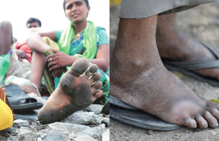 मीडिया से लेकर सोशल मीडिया तक में पलायन की ऐसी कई तस्वीरें आईं जिसे किसी की भी आंखें नम हो जाएं।