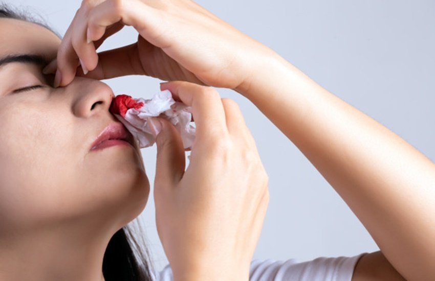 Nose Bleeding, how to stop nose bleeding, nose bleeding remedies, nose bleeding home remedies, home remedies for nose bleeding, nose bleeding first aid, cause of nose bleeding, Symptoms of nose bleeding