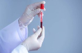 plasma therapy, plasma therapy for corona, plasma therapy for coronavirus, plasma therapy for corona procedure, plasma therapy in covid 19, plasma therapy in covid 19 in delhi, plasma therapy in covid 19 in india, plasma therapy in covid 19 in usa, plasma therapy process, plasma therapy procedure, plasma therapy kya hai, plasma therapy kya hai in hindi, plasma therapy cost in india, plasma therapy cost for covid-19, plasma therapy mhanje kay, plasma therapy mumbai, plasma therapy trial, plasma therapy latest news, coronavirus, coronavirus india, coronavirus symptoms, coronavirus treatment, coronavirus tally, coronavirus stats