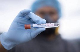 Corona Virus, Covid-19,