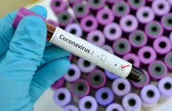 82000 कोरोना पॉजिटिव में 91% दिल्ली और 9 राज्यों से, बाकी 50 करोड़ आबादी में सिर्फ 7300+ संक्रमित