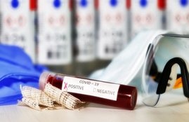 Coronavirus, coronavirus symptoms, coronavirus treatment, coronavirus cause, coronavirus ka ilaj, icmr guidelines for covid testing, coronavirus vaccine, coronavirus tips, coronavirus india update, coronavirus mumbai