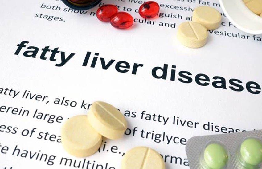 fatty liver, fatty liver symptoms, fatty liver precautions, fatty liver causes, fatty liver treatment, fatty liver and diabetes, fatty liver home remedies, home remedies for fatty liver, fatty liver ka ilaj, fatty liver ki dawa, fatty liver diet, fatty liver grade1, fatty liver grade 1, fatty liver cure, health news, health update, diabetes, high bp, high cholestrol, obesity