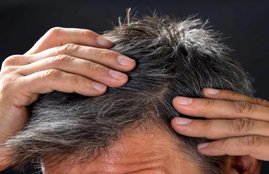 White Hair, White Hair Tips, white hair remedies, white hair diet, white hair diet in hindi, white hair remedies at home, white hair remedies natural, white hair remedies in hindi, white hair remedies food, white hair home remedies in hindi