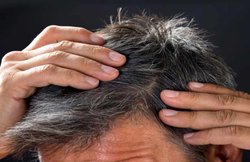 White Hair: मिनरल्स की कमी के कारण हो सकती है सफेद बालों की समस्या, जानिए कैसे रखें ध्यान