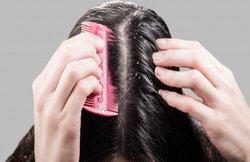 Hair Care Tips: डैंड्रफ की समस्या से छुटकारा दिलाने में मदद कर सकता है हल्दी वाला तेल, जानिये इस्तेमाल का तरीका