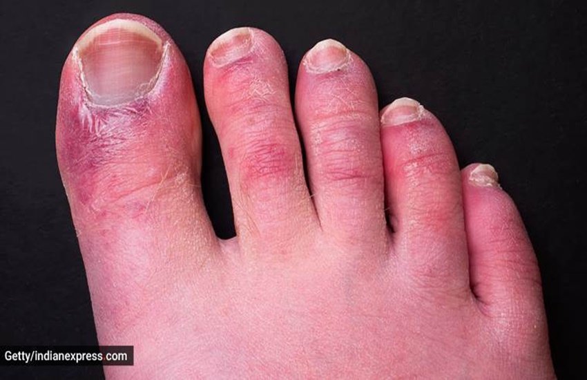 diabetes, diabetes symptoms, diabetes symptoms in leg, diabetes risk, blood sugar level, diabetes test