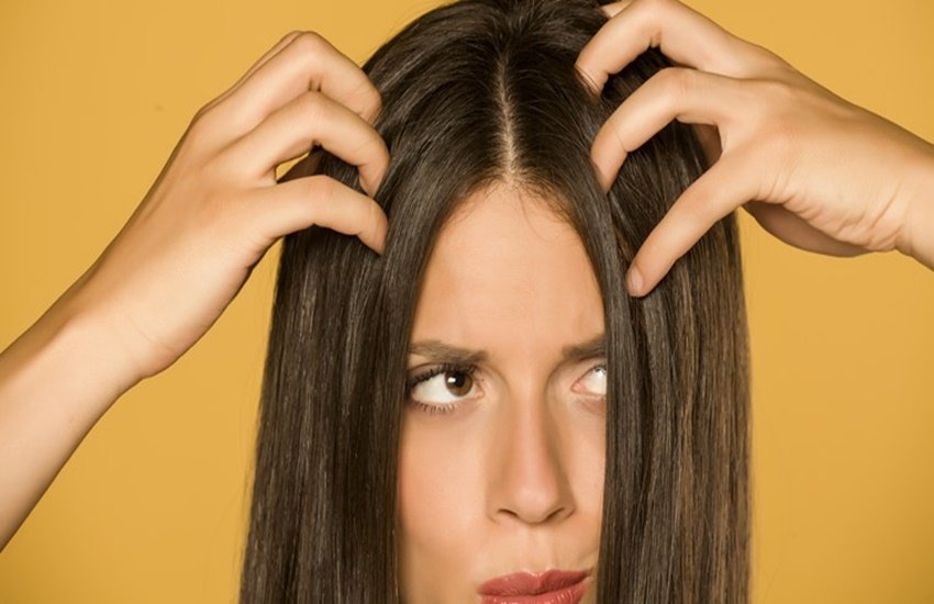 Oily hair, Hair problems, hair remedies, remedies for dandruff, hair care routine
