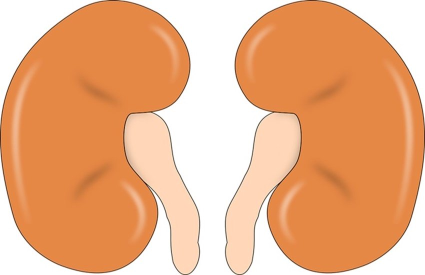 Kidney disease, Kidney Stone, Remedies for Kidney Stones, Kidney Stones symptoms