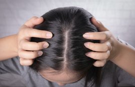 pimples on scalp, pimples on scalp remedy, pimples on scalp home remedies
