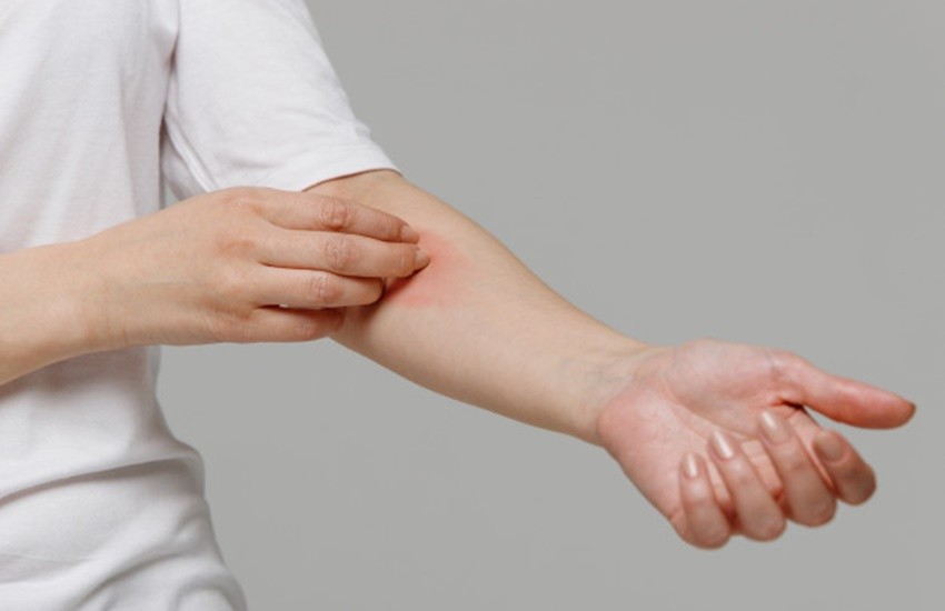 Uric Acid: त्वचा पर आने लगे लालीपन, तो जरूर कराएं यूरिक एसिड टेस्ट, ये ...