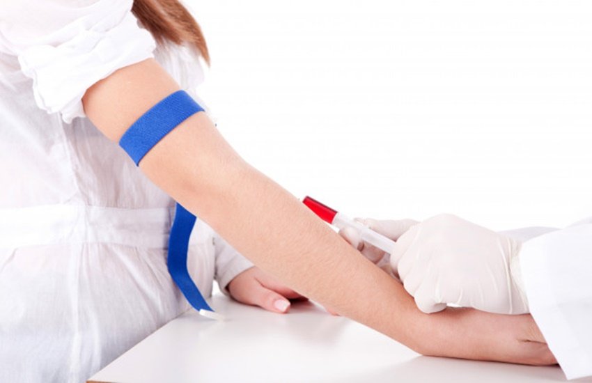 aplastic anemia, aplastic anemia causes, aplastic anemia treatment
