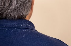 Hair Care Tips, White Hair, White Hair Remedies, White Hair treatment, hair problem