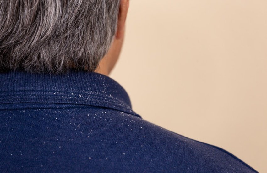 Hair Care Tips, White Hair, White Hair Remedies, White Hair treatment, hair problem