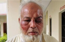 ‘मोदी जिंदाबाद’, ‘जय श्रीराम’ न बोलने पर बुजुर्ग ऑटो ड्राइवर की पिटाई, नोंची दाढ़ी; बदमाश बोले थे- PAK भेजकर ही मिलेगा चैन