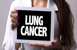 Sanjay dutt, Sanjay dutt lungs cancer, Sanjay dutt stage 3 lungs cancer, lung cancer initial symptoms, cancer