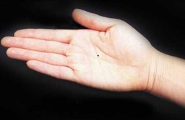 Til ka matlab, Moles meaning on body, Samudrik shastra, meaning of moles on hand, meaning of mole on right hand, meaning of mole on left hand
