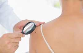 moles on body meaning, moles on body astrology in hindi, moles on body significance