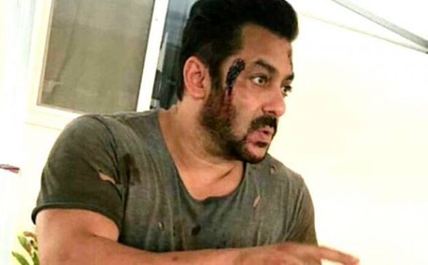 बॉलीवुड सुपरस्टार सलमान खान एक्शन फिल्में करने में पीछे नहीं रहते। फ़िल्म 'भारत' के दौरान उन्हें गंभीर चोट आई थी, जिससे पसली में जहां उन्हे चोट लगी, वहां हेयरलाइन फ्रेक्चर हो गया था। ऐसे ही 'वांटेड' फ़िल्म में एक्शन सीन करते हुए उन्हें चोट आई थी, और उन्हें सीधा हॉस्पिटल ले जाया गया था।