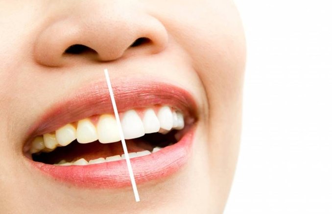 Yellow Teeth: पीले दांतों से हैं परेशान तो हल्दी का करें इस्तेमाल, जानिये कैसे होता है फायदेमंद