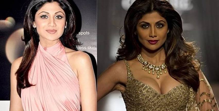 शिल्पा शेट्टी भी ब्रेस्ट एनलार्जमेंट सर्जरी करा चुकी हैं। उनके बारे में कहा जाता है कि उन्होंने अपनी नोज सर्जरी भी करवाई है। हालांकि उन्होंने कभी पब्लिक्ली ये बात कबूल नहीं की है।