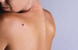 samudrik shastra back mole, samudrik shastra back mole meaning, back mole meaning mole meaning